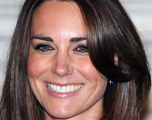 Kate Middleton e le foto in topless